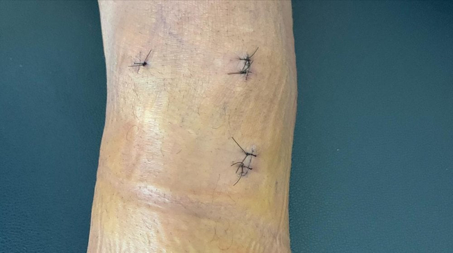 Slider image (3) Sports Medicine Systems